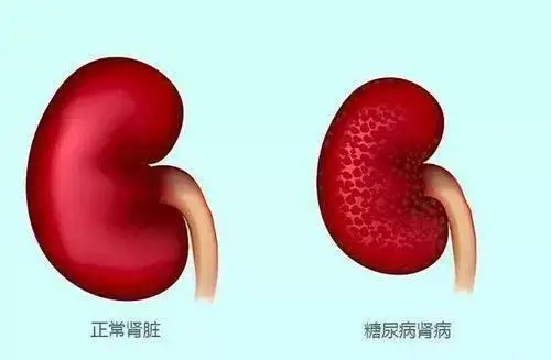 图片细节